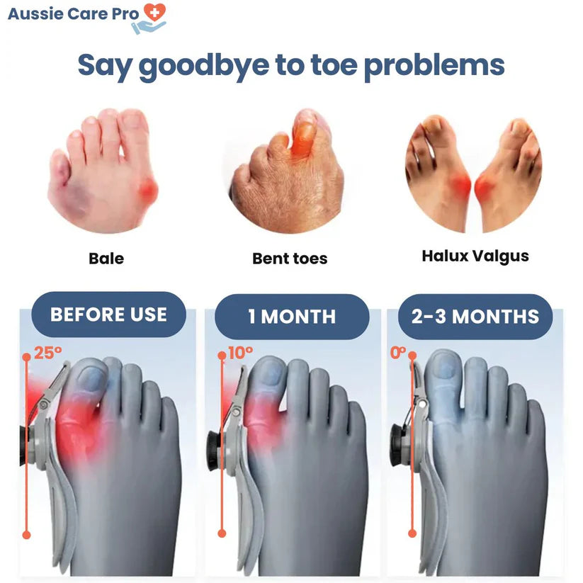 StepEaseā¢Bunion Corrector
